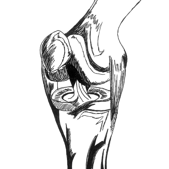 Anterior Cruciate Ligament RACHEL FUNG | The Broadview