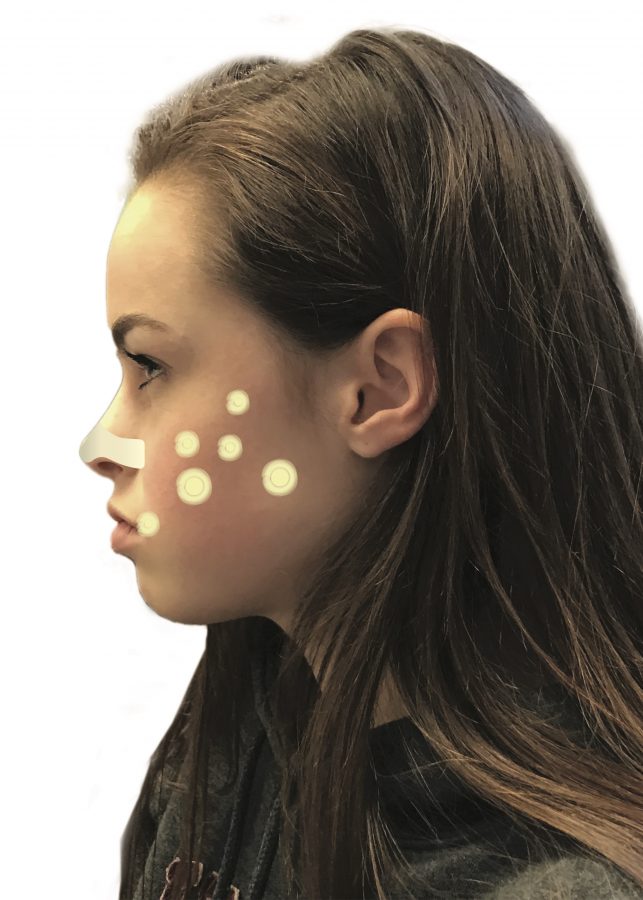 Personalized skin care gets spotty